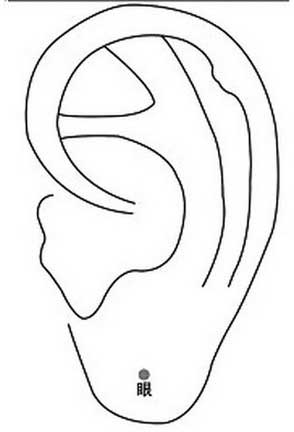 眼保健操图解：让您轻松学会眼保健操