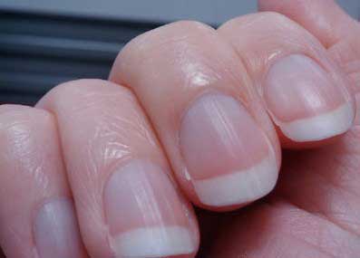 指甲看健康 了解身体的预警信号