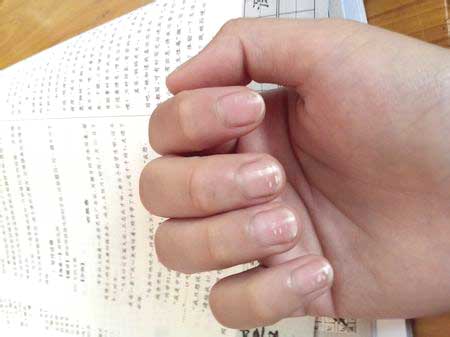 指甲上有白点是怎么回事