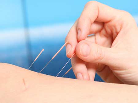告别针灸减肥反弹_还你好身材