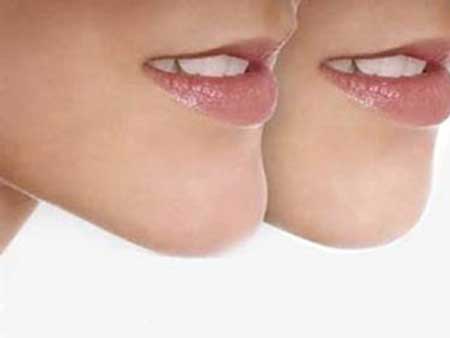 六个方法专减双下巴