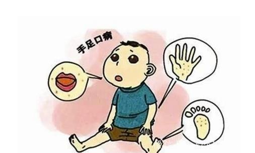 手足口病的发病原因及治疗方法