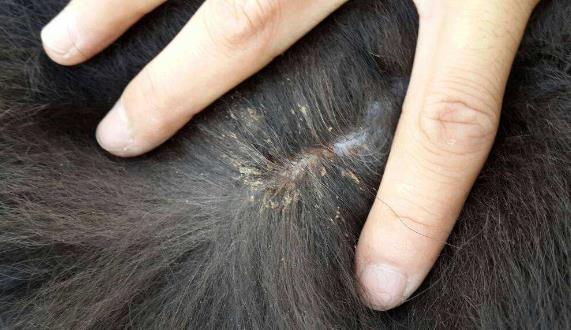 头上长虱子怎么去除 去虱子和虱子卵的有效方法