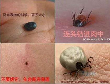 头上长虱子怎么去除 去虱子和虱子卵的有效方法