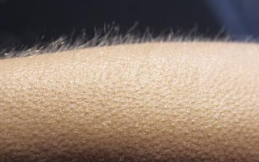 起鸡皮疙瘩的反应 鸡皮肤与鸡皮疙瘩的差异