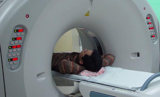 有人对于CT检查谈及色变 CT检查不一定会致癌