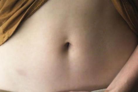 肚脐有黑泥抠掉会怎样 方法不对伤害大别再乱处理了