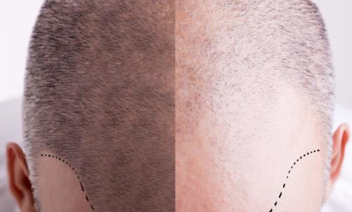 头发少要怎么保养 预防脱发十秘诀