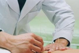 针灸的减肥原理及作用