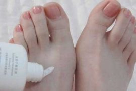 一个中医常用的治疗“脚气烂脚丫脚癣”的方子