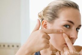 日常生活中如何有效预防青春痘 注意防晒和脸部清洁