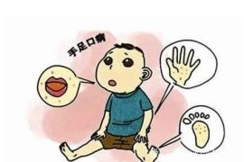 手足口病的发病原因及治疗方法
