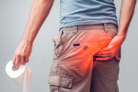 久坐人群避免痔疮危害 治疗痔疮有效的9个偏方