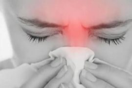 过敏性鼻炎容易反复 缓解鼻炎症状的10种小偏方