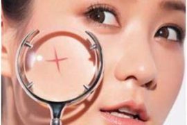 有黑头怎么办啊?——不要用手挤