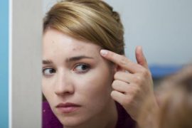 不同部位长痘原因不同 视而不见会加重你的问题