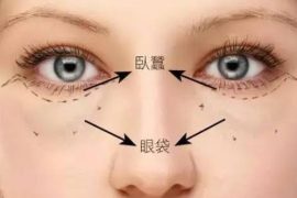 按摩5大穴位去眼袋效果好 去眼袋小妙招助你消除眼袋