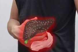 治疗黄疸型肝炎的9则小偏方 能有效治疗黄疸型肝炎