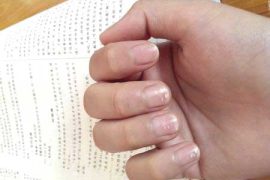 指甲上有白点是怎么回事