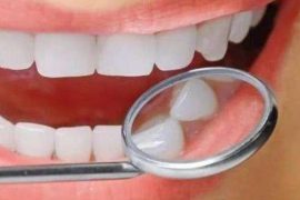 导致牙齿发黄的5大原因 搭配不同的食物进行美白牙齿